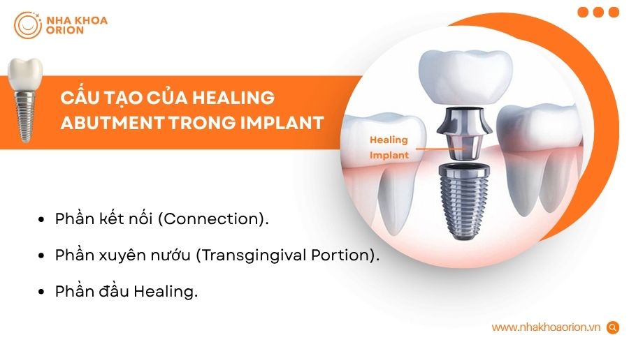 Healing Implant gồm c&aacute;c th&agrave;nh phần hỗ trợ bảo vệ trụ v&agrave; tạo h&igrave;nh m&ocirc; nướu