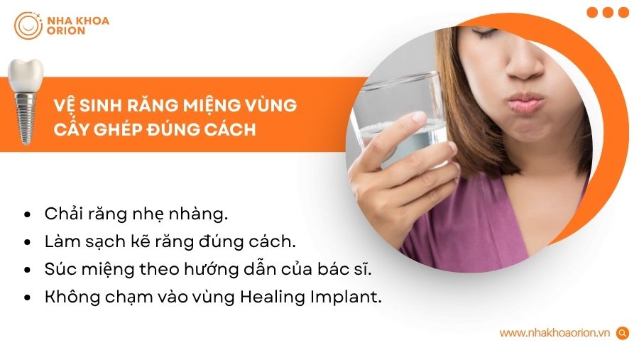 Vệ sinh đ&uacute;ng c&aacute;ch gi&uacute;p giảm vi khuẩn v&agrave; bảo vệ m&ocirc; nướu quanh Healing Implant