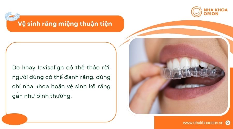 Khay niềng tháo rời giúp vệ sinh răng miệng dễ dàng hơn