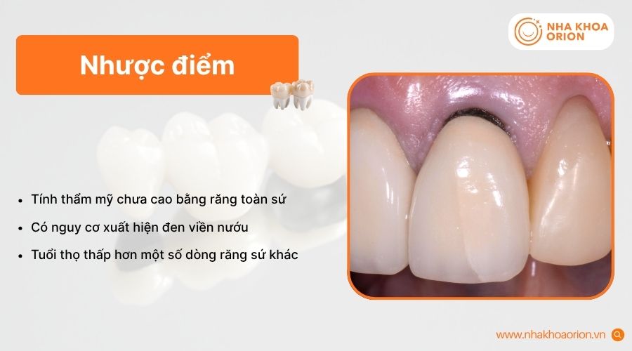 Răng sứ Titan có thể giảm tính thẩm mỹ sau thời gian sử dụng