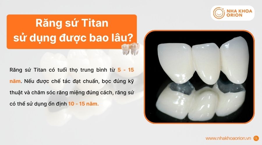 Răng sứ Titan có tuổi thọ từ 5 - 15 năm nếu chăm sóc đúng cách