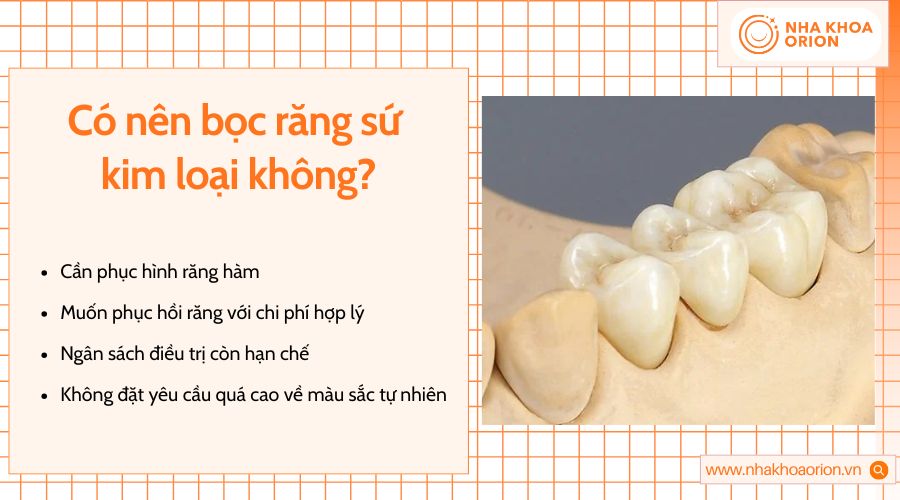 Răng sứ kim loại phù hợp khi ưu tiên độ bền, ăn nhai và chi phí hợp lý
