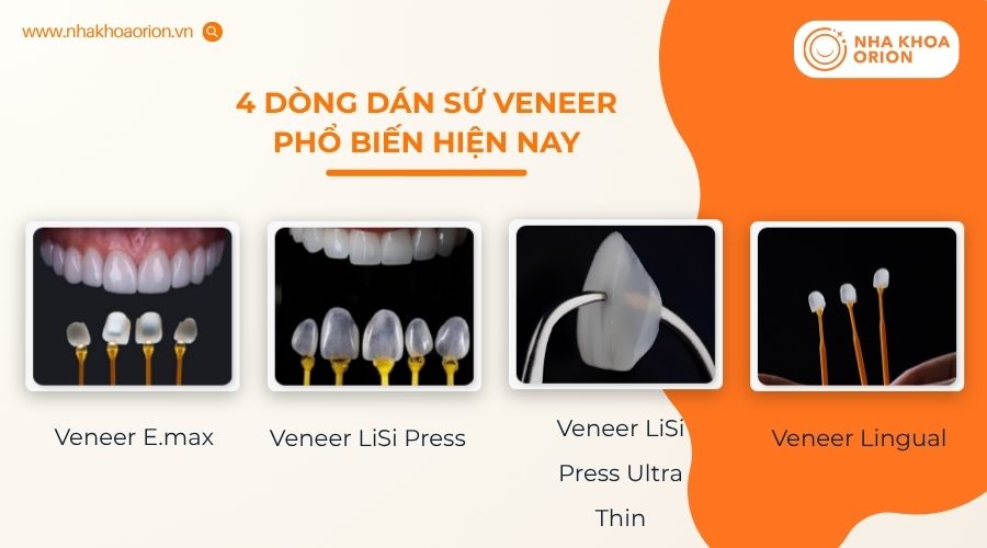 Khách hàng có nhiều lựa chọn mặt dán sứ phù hợp với nhu cầu