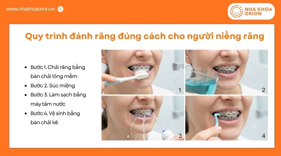 Người niềng răng cần thực hiện c&aacute;c bước vệ sinh chuy&ecirc;n biệt để l&agrave;m sạch quanh mắc c&agrave;i