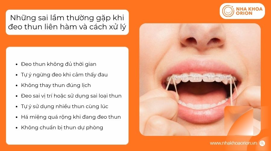 Đeo thun kh&ocirc;ng đủ thời gian c&oacute; thể k&eacute;o d&agrave;i qu&aacute; tr&igrave;nh niềng răng