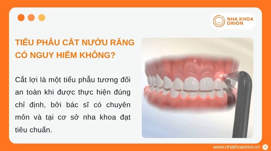 Cắt lợi sẽ tiềm ẩn một số rủi ro nếu thực hiện kh&ocirc;ng đ&uacute;ng kỹ thuật