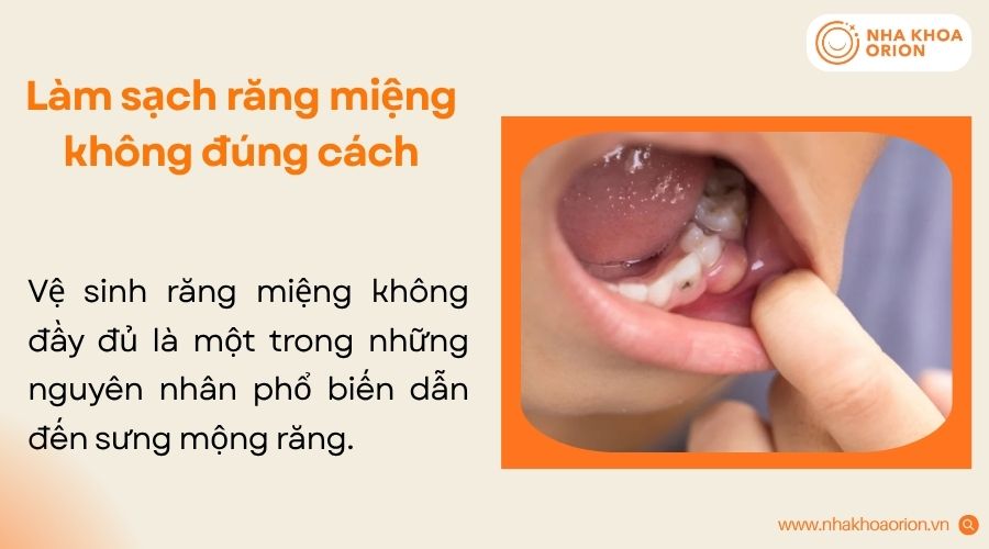 Vệ sinh sai cách khiến mảng bám tích tụ và tạo điều kiện cho vi khuẩn phát triển