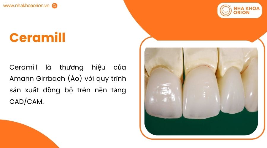 Lava sử dụng Zirconia đa lớp, mang lại màu răng chuyển sắc tự nhiên