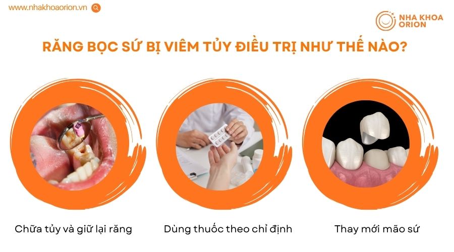 Chữa vi&ecirc;m tủy kịp thời gi&uacute;p bảo vệ răng thật v&agrave; m&atilde;o sứ