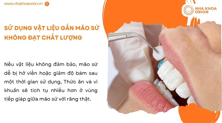 Vật liệu đạt chuẩn gi&uacute;p m&atilde;o sứ b&aacute;m chắc v&agrave; bảo vệ răng thật tốt hơn