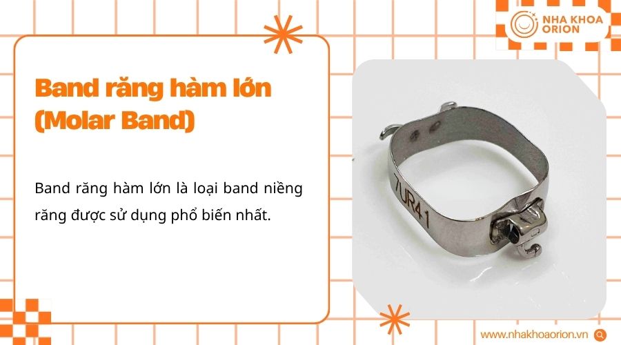 Band răng h&agrave;m lớn l&agrave; v&ograve;ng kim loại gắn tr&ecirc;n răng cối để tạo điểm neo