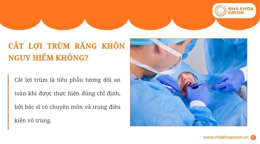 Mức độ an toàn khi cắt lợi trùm phụ thuộc vào kỹ thuật thực hiện và tình trạng răng