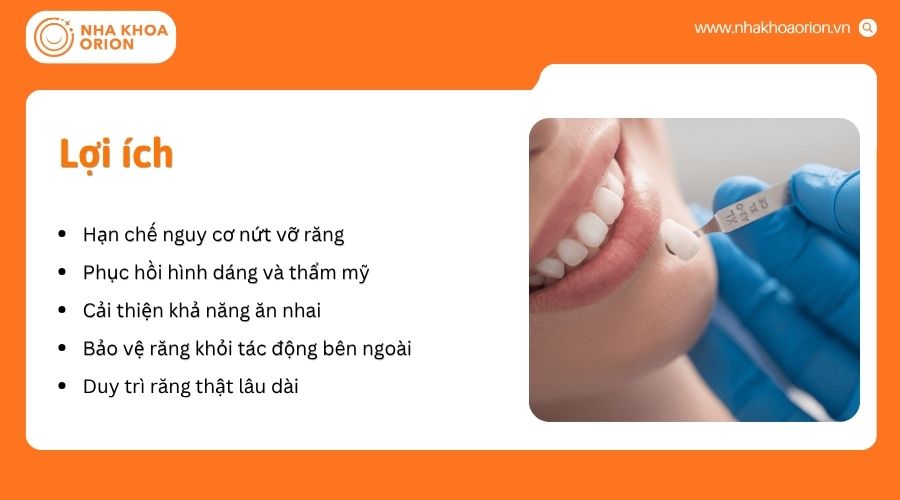 Bọc răng sứ sau lấy tủy mang lại nhiều lợi &iacute;ch trong phục hồi răng