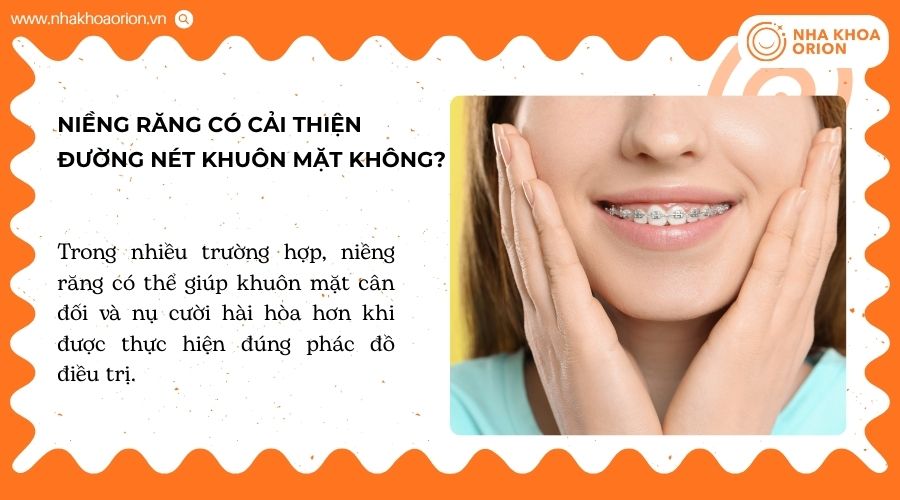Niềng răng có thể giúp khuôn mặt cân đối và nụ cười hài hòa hơn