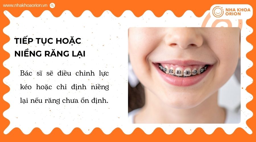 Bác sĩ sẽ lựa chọn phương án tiếp tục hoặc niềng răng lại phù hợp với từng trường hợp