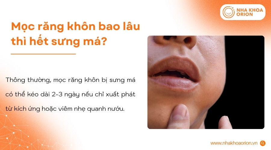 Sưng m&aacute; do mọc răng kh&ocirc;n thường giảm sau v&agrave;i ng&agrave;y nếu kh&ocirc;ng c&oacute; vi&ecirc;m nhiễm