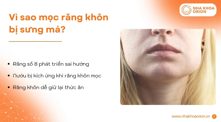 Răng kh&ocirc;n mọc lệch, vi&ecirc;m nướu hoặc t&iacute;ch tụ thức ăn c&oacute; thể khiến v&ugrave;ng m&aacute; bị sưng đau