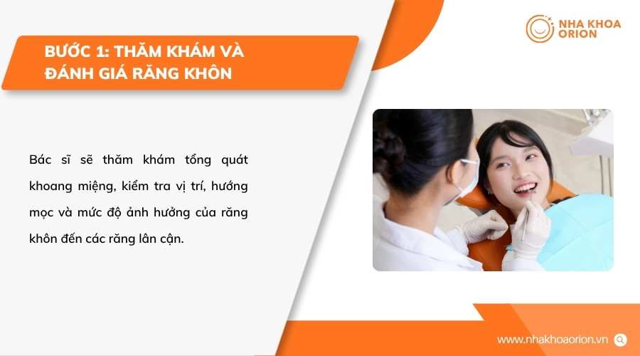 B&aacute;c sĩ thăm kh&aacute;m v&agrave; chụp phim để x&aacute;c định ch&iacute;nh x&aacute;c t&igrave;nh trạng răng kh&ocirc;n