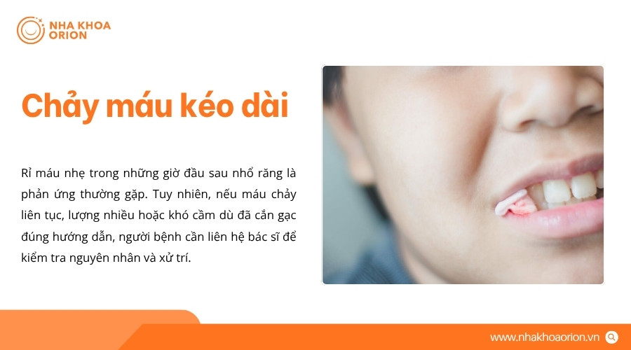 Chảy m&aacute;u nhiều hoặc kh&ocirc;ng thể kiểm so&aacute;t sau nhổ răng cần được b&aacute;c sĩ kiểm tra&nbsp;