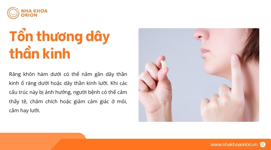 Tổn thương d&acirc;y thần kinh c&oacute; thể g&acirc;y t&ecirc; hoặc giảm cảm gi&aacute;c ở m&ocirc;i, cằm v&agrave; lưỡi