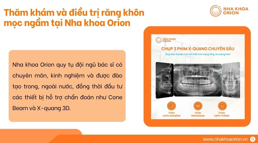 Nha khoa Orion tư vấn xử l&yacute; răng kh&ocirc;n ph&ugrave; hợp từng trường hợp