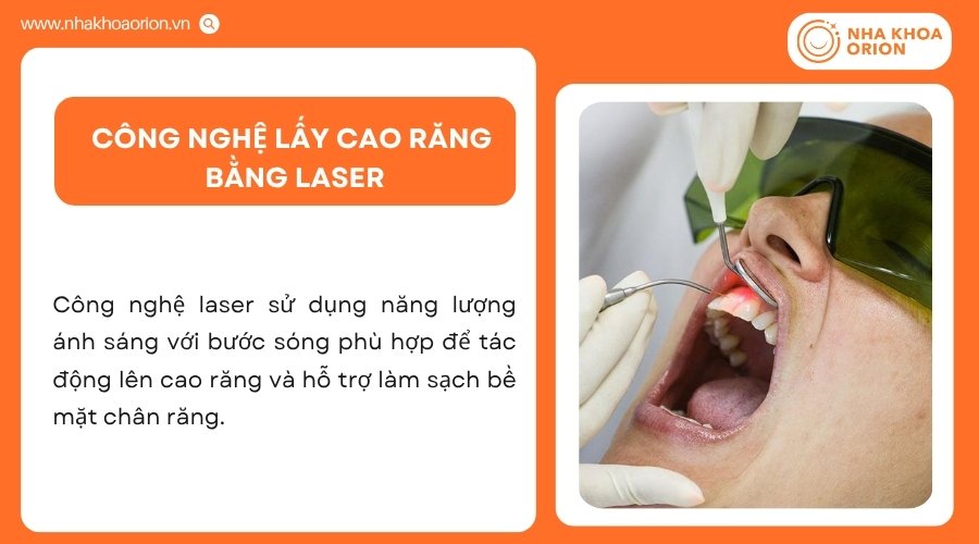 Laser hỗ trợ loại bỏ cao răng và làm sạch bề mặt chân răng