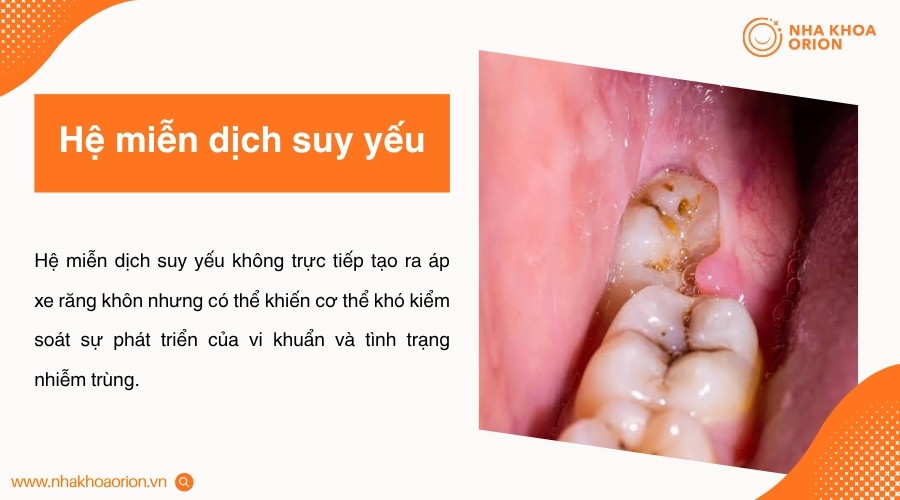Hệ miễn dịch suy yếu c&oacute; thể l&agrave;m giảm khả năng kiểm so&aacute;t vi khuẩn trong khoang miệng