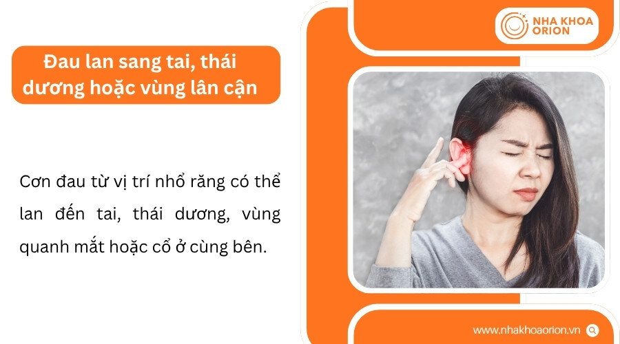 Cơn đau từ ổ nhổ c&oacute; thể lan sang tai, th&aacute;i dương v&agrave; v&ugrave;ng l&acirc;n cận