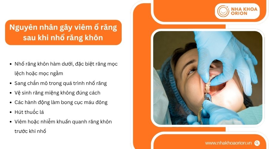 Vi&ecirc;m ổ răng thường li&ecirc;n quan đến cục m&aacute;u đ&ocirc;ng mất ổn định hoặc bong khỏi ổ nhổ