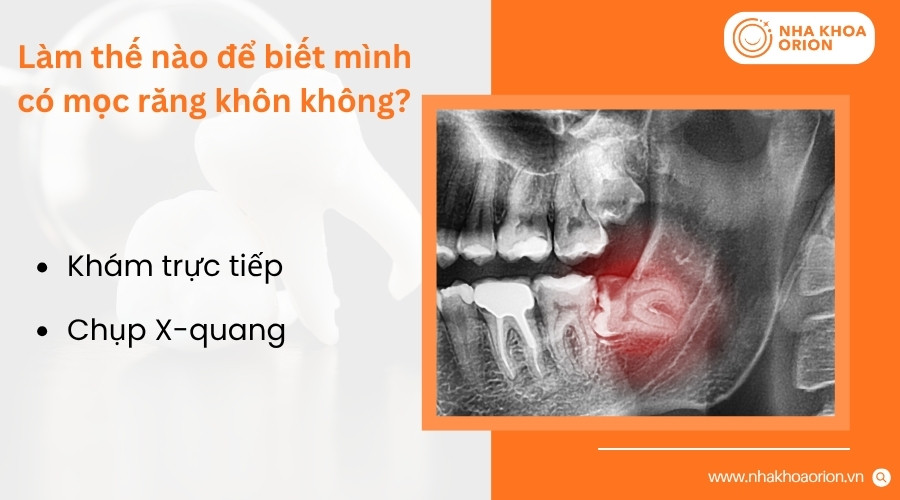 Thăm kh&aacute;m v&agrave; chụp X-quang gi&uacute;p x&aacute;c định ch&iacute;nh x&aacute;c sự tồn tại v&agrave; vị tr&iacute; của răng kh&ocirc;n