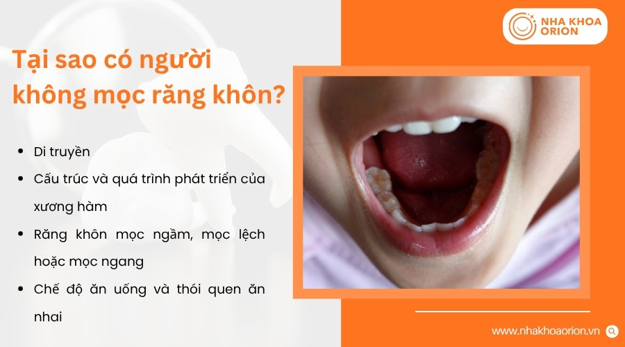 C&oacute; nhiều nguy&ecirc;n nh&acirc;n khiến một người kh&ocirc;ng mọc hoặc kh&ocirc;ng c&oacute; đủ răng kh&ocirc;n