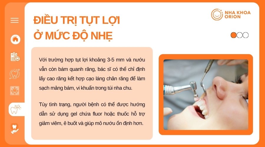 Tụt lợi nhẹ c&oacute; thể kiểm so&aacute;t bằng l&agrave;m sạch nha chu v&agrave; chăm s&oacute;c nướu đ&uacute;ng c&aacute;ch