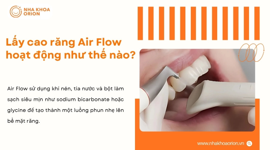 Air Flow tạo luồng phun nhẹ để cuốn trôi mảng bám, vết ố và cặn bẩn