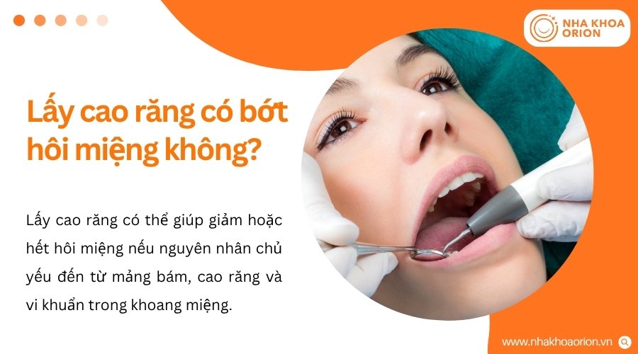 Lấy cao răng giúp giảm hôi miệng khi mảng bám và vi khuẩn là nguyên nhân chính