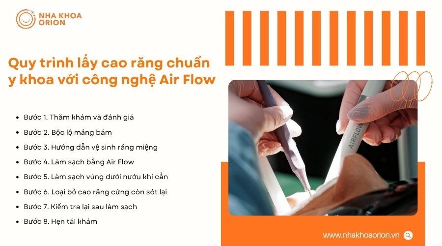 Quy trình Air Flow gồm các bước thăm khám, làm sạch, kiểm tra và hướng dẫn chăm sóc