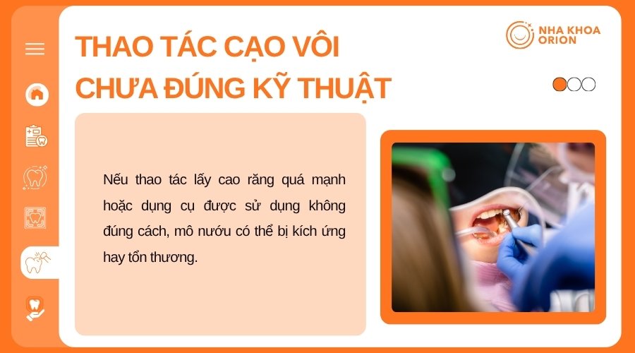 Thao t&aacute;c cạo v&ocirc;i qu&aacute; mạnh hoặc sai c&aacute;ch c&oacute; thể l&agrave;m tổn thương m&ocirc; nướu