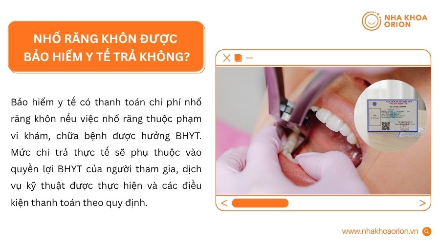 BHYT c&oacute; thể chi trả chi ph&iacute; nhổ răng kh&ocirc;n khi việc điều trị đ&aacute;p ứng điều kiện theo quy định