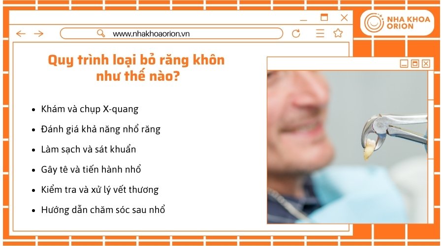 Quy trình nhổ răng khôn được thực hiện theo từng bước cụ thể