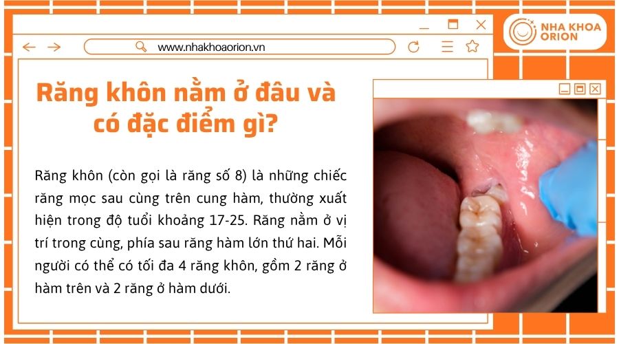 Răng khôn mọc sau cùng, thường xuất hiện khi xương hàm đã phát triển gần hoàn thiện