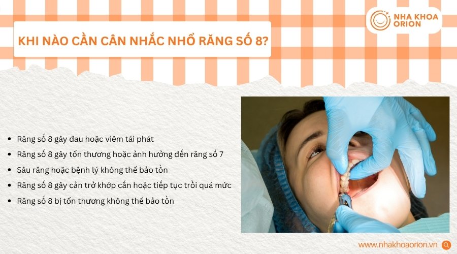 Răng số 8 cần nhổ khi g&acirc;y đau, vi&ecirc;m nhiễm hoặc ảnh hưởng răng b&ecirc;n cạnh