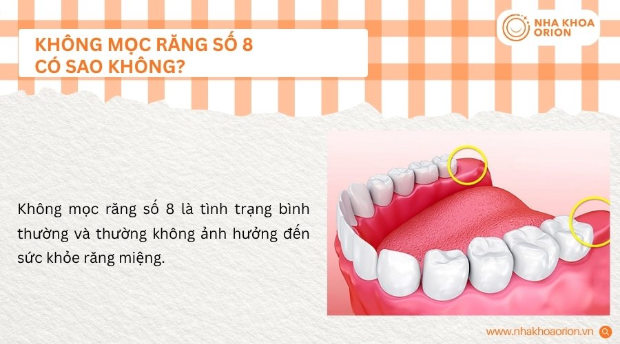 Kh&ocirc;ng mọc răng số 8 vẫn l&agrave; t&igrave;nh trạng b&igrave;nh thường ở nhiều người
