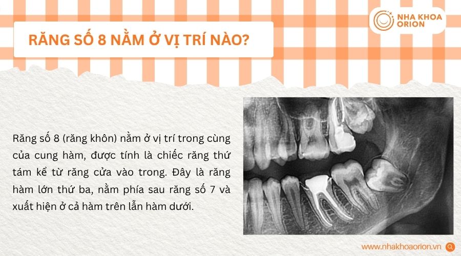 Răng số 8 nằm ph&iacute;a sau răng số 7 tr&ecirc;n cung h&agrave;m
