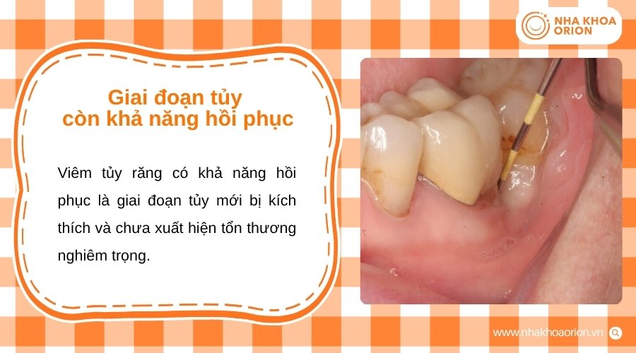 Tủy răng mới tổn thương và vẫn duy trì khả năng phục hồi