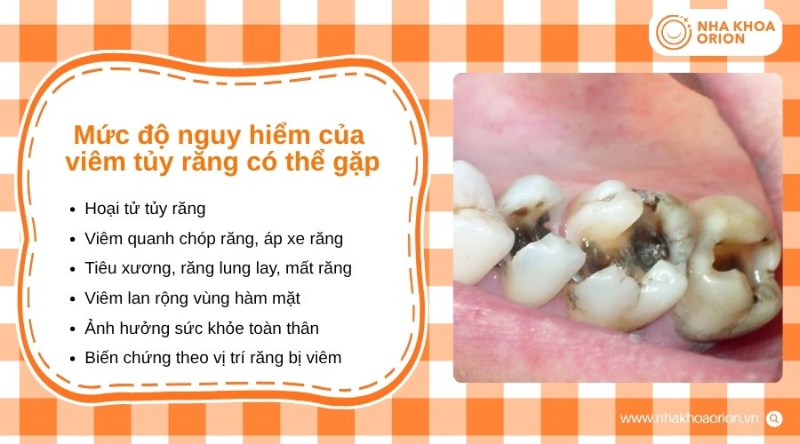Viêm tủy kéo dài có thể gây nhiều biến chứng nghiêm trọng