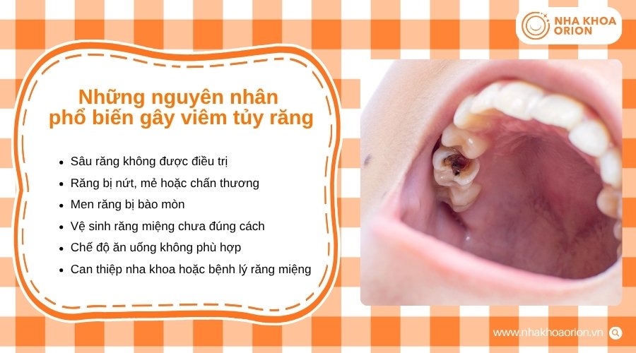 Vi khuẩn xâm nhập là yếu tố chính gây tổn thương tủy