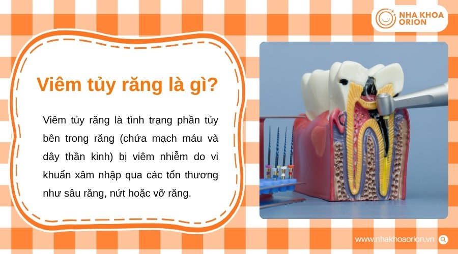 Viêm tủy răng gây tổn thương phần mô bên trong răng