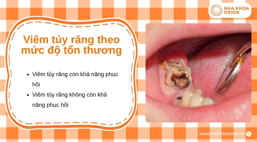 Mức độ tổn thương quyết định khả năng phục hồi của tủy răng