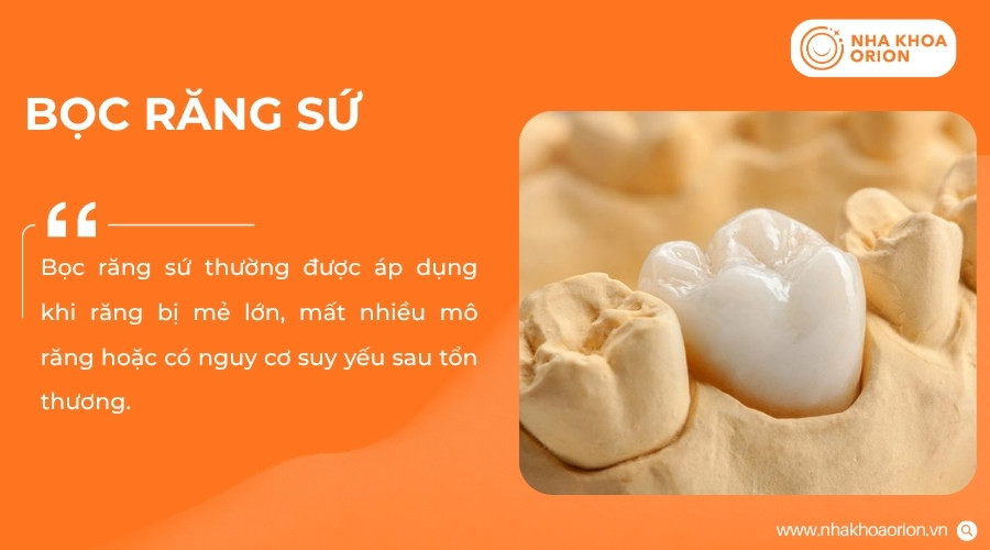 Bọc răng sứ giúp bảo vệ răng mẻ lớn và phục hồi chức năng nhai