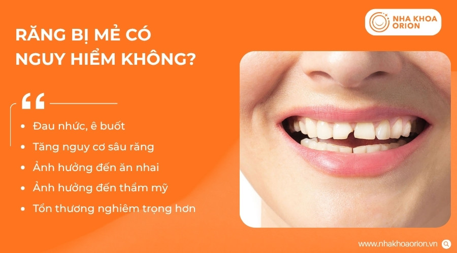 Răng bị mẻ có thể ảnh hưởng đến thẩm mỹ và sức khỏe răng miệng