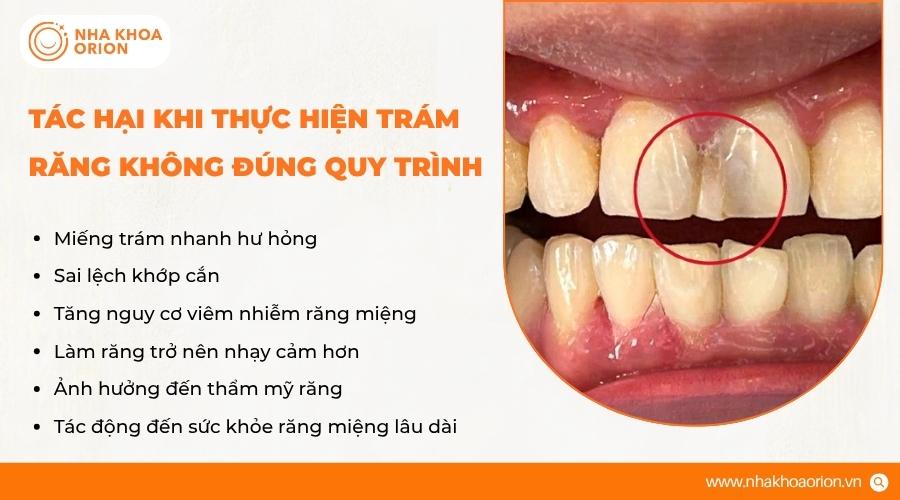 Tr&aacute;m răng sai kỹ thuật c&oacute; thể ảnh hưởng đến độ bền v&agrave; sức khỏe răng miệng